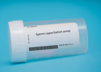 Fototapeta na wymiar Sperm capacitation assay