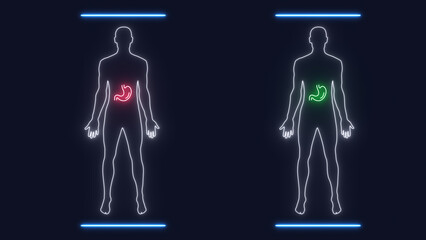 Analysis of human male silhouette scan with x ray gastro organs. Interface exam digestive systemin sick red and healthy green state. Concept of diagnosis medicine and healthcare. High quality 8K