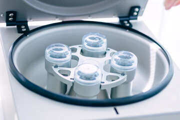 A large complex of a modern robotic machine for blood centrifugation and analysis. Hospital laboratories, automatic biochemical analyzer. - obrazy, fototapety, plakaty