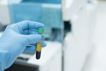 Scientist hand wearing blue glove hold blood test tube and plasma ready for laboratory...