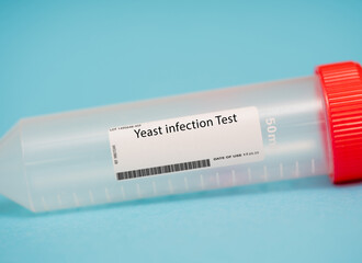Yeast infection Test