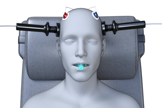 Electroconvulsive therapy, ECT, a treatment involving the use of electrical currents to stimulate the brain, 3D illustration