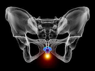 A 3D medical illustration highlighting the coccyx bone marked in red, depicting coccyx pain - obrazy, fototapety, plakaty