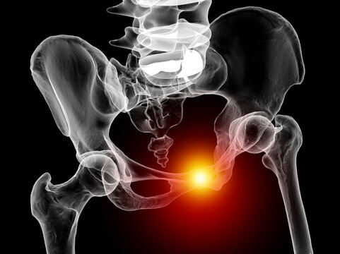 Symphysis pubis dysfunction, 3D illustration
