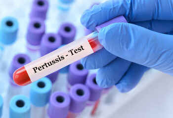 Doctor holding a test blood sample tube with Pertussis test on the background of medical test tubes with analyzes.