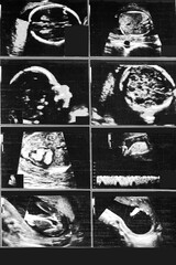 ultrasound picture baby memory photography
