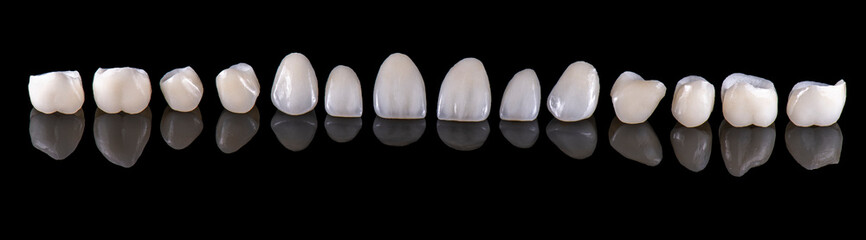 Emax ceramic crowns and veneers like natural teeth