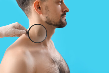 Dermatologist examining mole of young man with magnifier on blue background, closeup