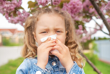 The child wipes his nose with a napkin. Seasonal allergy to flowers.