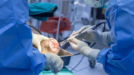Doctor or surgeon in blue uniform using surgical saw inside modern operating room in hospital.Foot...