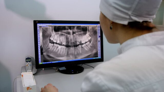 Dentist examines X-ray picture of patient teeth on computer with help of modern digital X-ray equipment. Doctor brings closer picture of problematic part
