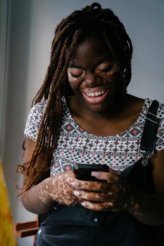 Girl with vitiligo in her painting studio laughing after reading a message on her mobile phone