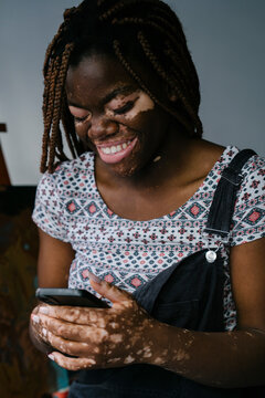 Girl with vitiligo in her painting studio laughing after reading a message on her mobile phone