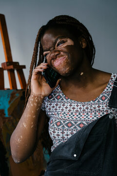 Girl with vitiligo in her painting studio talking on her phone while laughing