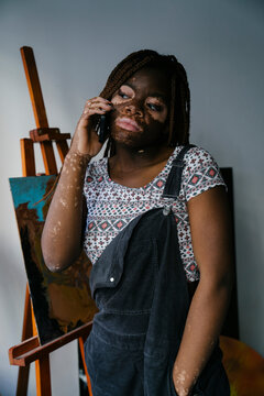 Girl with vitiligo in her painting studio talking on her phone