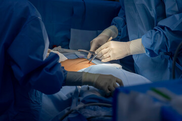 Doctor or surgeon in blue surgical gown did surgery inside operating room in hospital.People did...