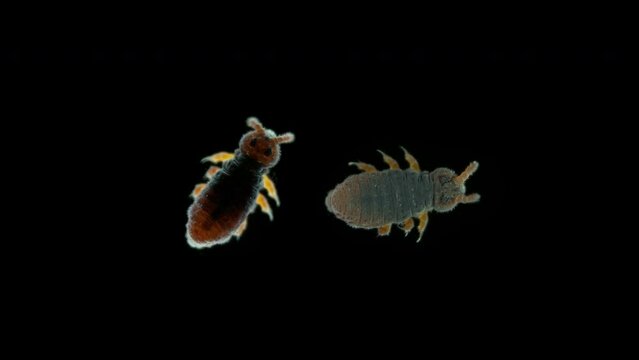 Insecta Collembola family Poduridae under a microscope, Order Poduromorpha. They live on surface of water in ponds, puddles, can jump, they feed on organic matter, mushrooms, algae.