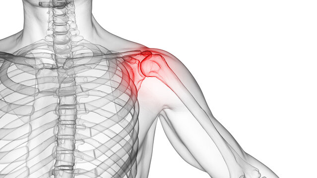 3d medical illustration of shoulder pain