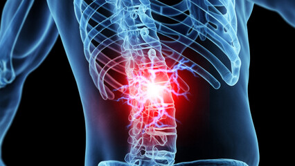 3d medical illustration of lower back pain - 596364160