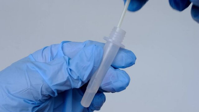 closeup female hands, assistant makes express test in medical scientific laboratory, stirs sample of genetic sample, concept of determining ethnic origin, paternity, covid-19 infection