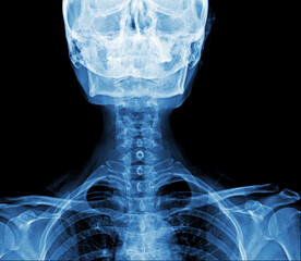 Film x-ray skull and cervical spine lateral view