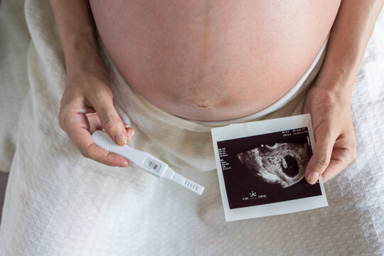 Pregnant woman wearing white shirts, hand holding pregnancy test ultrasound scan examination picture in front of her round belly on white background.
