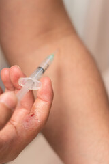 Vertical view of person with dermatological problem trying to self inject with a syringe with copy space