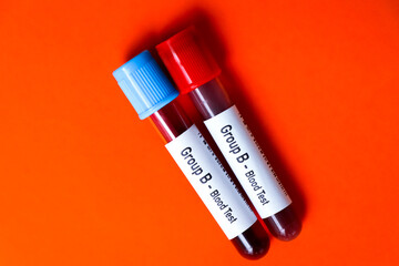 Group B - Blood Test, blood sample to analyze in the laboratory
