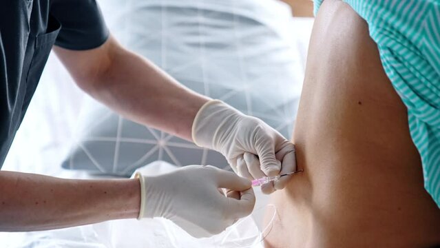 Gloved hands of a doctor giving epidural anesthesia to a patient&rsquo;s back. Preparation for the child birth.