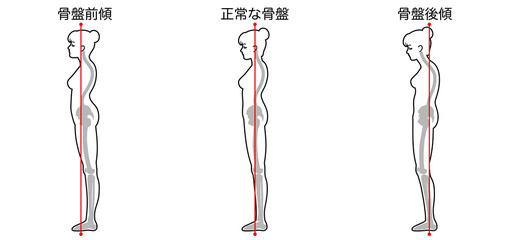 骨盤の角度と姿勢
