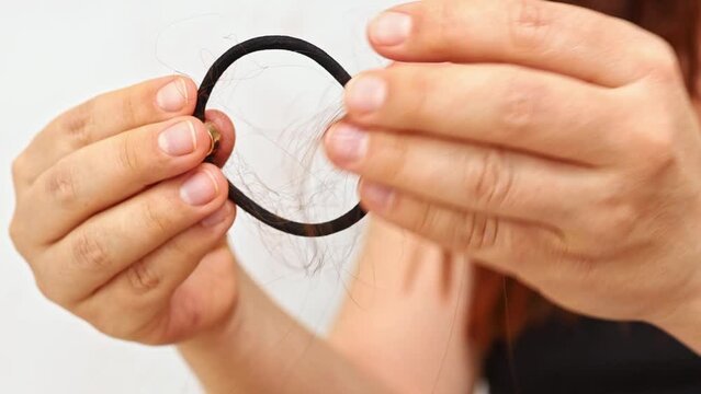 Women's hands in front of camera remove lot of fallen hair from elastic band. Alopecia. Close-up. Lack of trace elements. Hair treatment. Stress and illness. Aggressive environment. 4k footage.