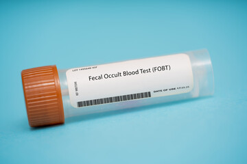 Fecal Occult Blood Test (FOBT)