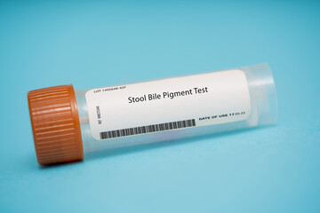 Stool Bile Pigment Test
