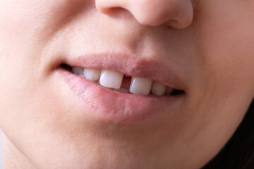 Close up of woman's open smiling mouth with gap teeht. Lips and unusual teeth