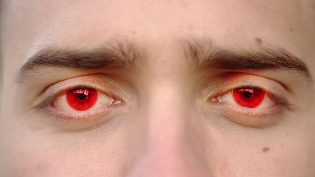Stressed person with red eye pupils looks straight macro