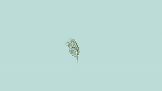 Rotifera Keratella sp. under a microscope, family Brachionidae. It has cosmopolitan distribution. Sample found in freshwater pond. Famale with eggs