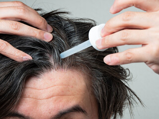 Fototapeta premium 頭皮に育毛剤を塗る男性 スカルプケア