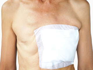 Breast cancer surgery by removing both breast.