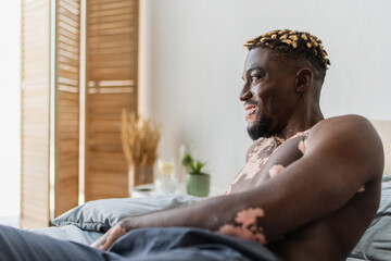 Side view of positive and shirtless african american man with vitiligo lying on bed at home.