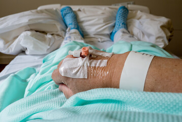 A hospital patient's hand fitted with a devise for intravenous therapy allowing medications and nutrients directly into the vein.