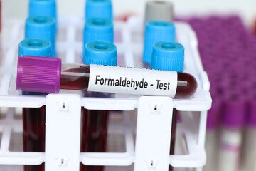 Formaldehyde test, blood sample to analyze in the laboratory