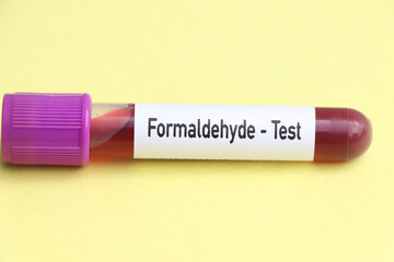 Formaldehyde test, blood sample to analyze in the laboratory