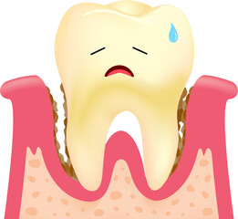 Dental plaque problem. Cartoon tooth character with gum.  Illustration.