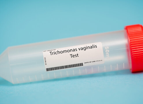 Trichomonas vaginalis Test