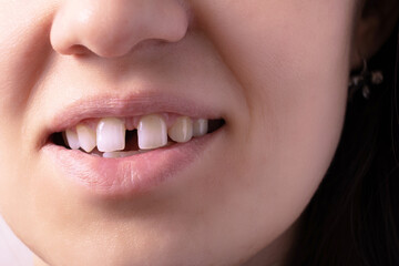 Close up of woman's open smiling mouth with gap teeht. Lips and unusual teeth