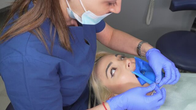 Dentist's hands in gloves with dental punch and cofferdam scarf. Dentist treats woman's tooth to patient with rubber dam. Modern dental office. Treatment elimination of caries, installation of filling