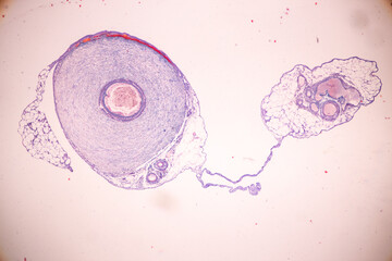 Histological Spermatic cord human, Seminal vesicle human, Prostate human and Human chromosomes...