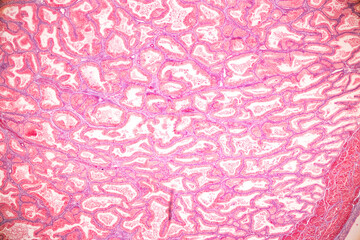 Histological Spermatic cord human, Seminal vesicle human, Prostate human and Human chromosomes...
