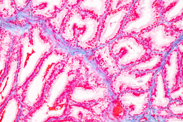 Histological Spermatic cord human, Seminal vesicle human, Prostate human and Human chromosomes under the microscope for education.