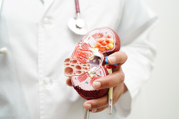 Chronic kidney disease, doctor holding model for treatment urinary system, urology, Estimated...